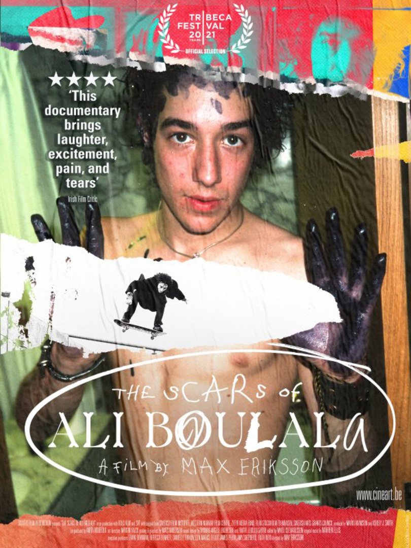 The Scars of Ali Boulala